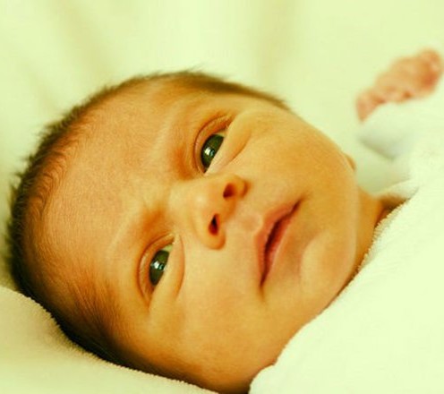 Trẻ sơ sinh có hiện tượng vàng da sinh lí do trẻ có số lượng hồng cầu trong máu lớn