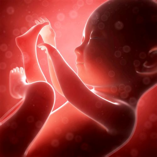 Bại não ở trẻ sơ sinh có thể do các nguyên nhân trước khi sinh
