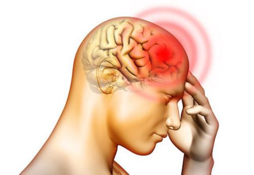 Đau đầu, hoa mắt, mất ngủ là những triệu chứng điển hình của thiếu máu não